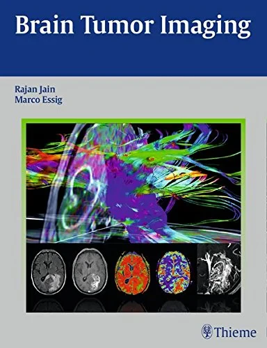 Coperta cărții "Brain Tumor Imaging" de Rajan Jain and Marco Essig
