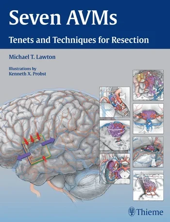 Coperta cărții " Seven AVMs" de Michael Lawton