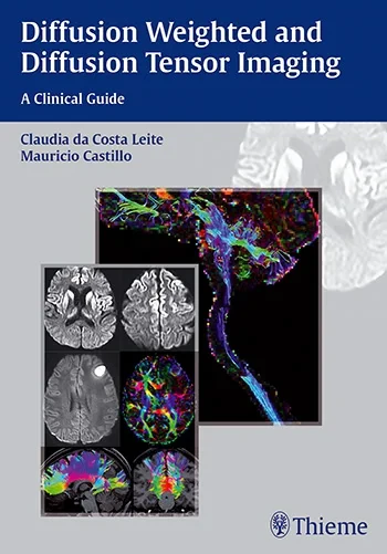Coperta cărții " Diffusion Weighted and Diffusion Tensor Imaging: A Clinical Guide" de Claudia Leite, Mauricio Castillo