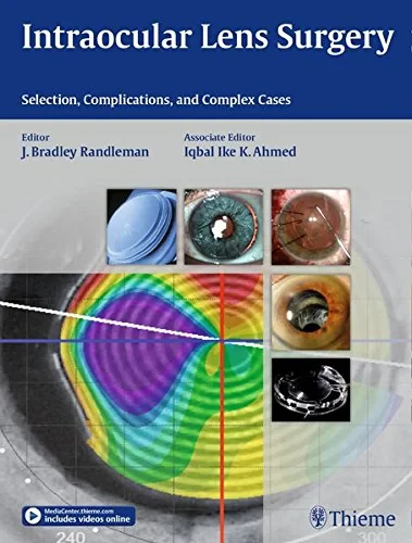 Coperta cărții " Intraocular Lens Surgery" de Bradley Randlema, Iqbal Ike K. Ahmed