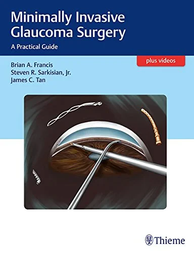 Coperta cărții "Minimally Invasive Glaucoma Surgery: A Practical Guide" de Brian Francis, Steven Sarkisian, James C. Tan