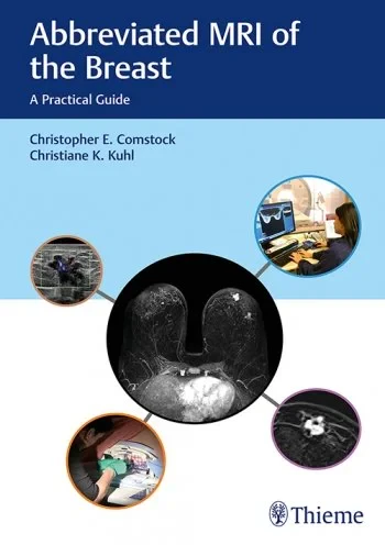 Coperta cărții " Abbreviated MRI of the Breast" de Christopher E. Comstock, Christiane Kuhl
