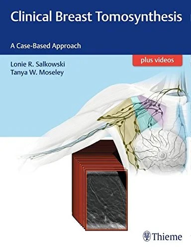 Coperta cărții "Clinical Breast Tomosynthesis" de Lonie R. Salkowski, Tanya Moseley