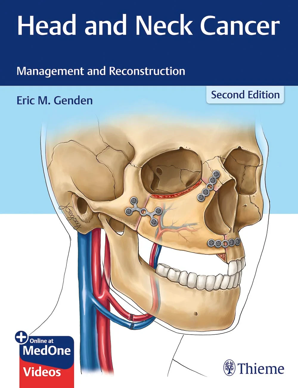 Coperta cărții "Head and Neck Cancer: Management and Reconstruction" de Eric M. Genden, Eric M. Genden�