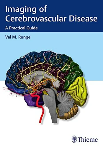 Coperta cărții " Imaging of Cerebrovascular Disease" de Val M. Runge