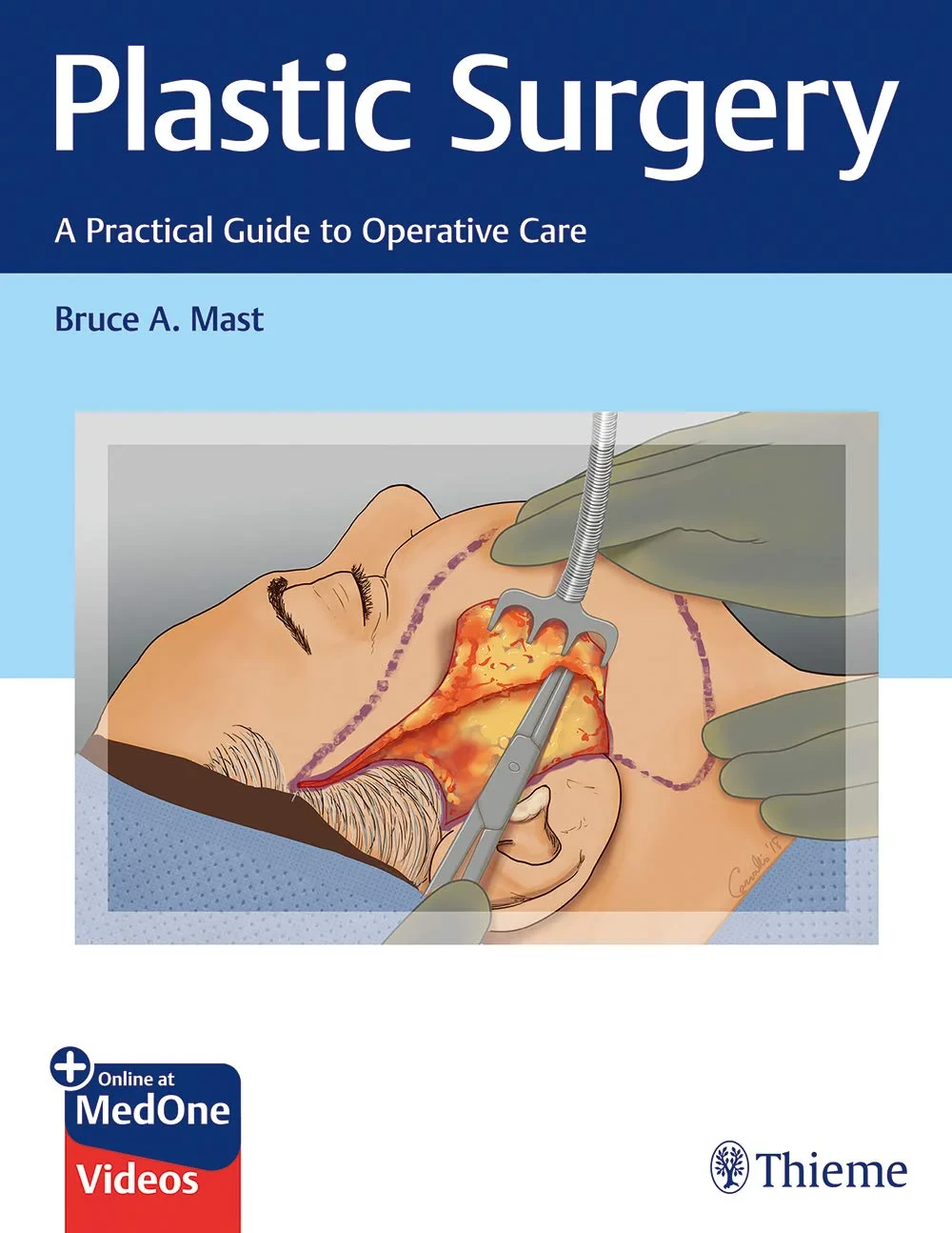 Coperta cărții "Plastic Surgery: A Practical Guide to Operative Care: A Practical Guide to Patient Care" de Bruce A. Mast