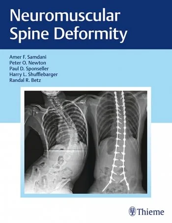 Coperta cărții " Neuromuscular Spine Deformity" de Amer Samdani, Peter O. Newton