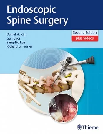 Coperta cărții "Endoscopic Spine Surgery" de Daniel H. Kim, Gun Choi