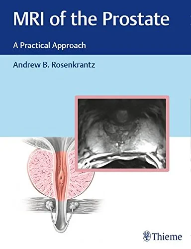 Coperta cărții "MRI of the Prostate: A Practical Approach" de Andrew Rosenkrantz
