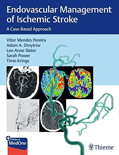 Coperta cărții "Endovascular Management of Ischemic Stroke: A Case-Based Approach " de Vitor Mendes Pereira (Author), Adam A. Dmytriw (Author), Lee-Anne Slater (Author), Sarah Power