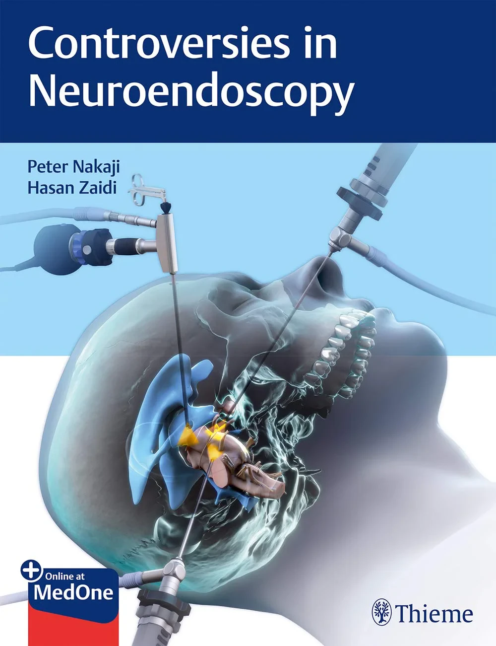 Coperta cărții "Controversies in Neuroendoscopy " de Peter Nakaji, Hasan A. Zaidi