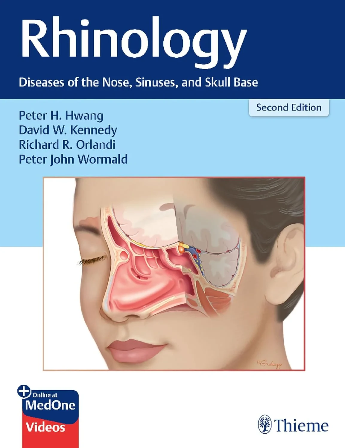 Rhinology: Diseases of the Nose, Sinuses, and Skul...