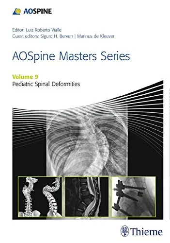 Coperta cărții "AOSpine Masters Series, Volume 9: Pediatric Spinal Deformities" de Marinus de Kleuver, Sigurd H. Berven