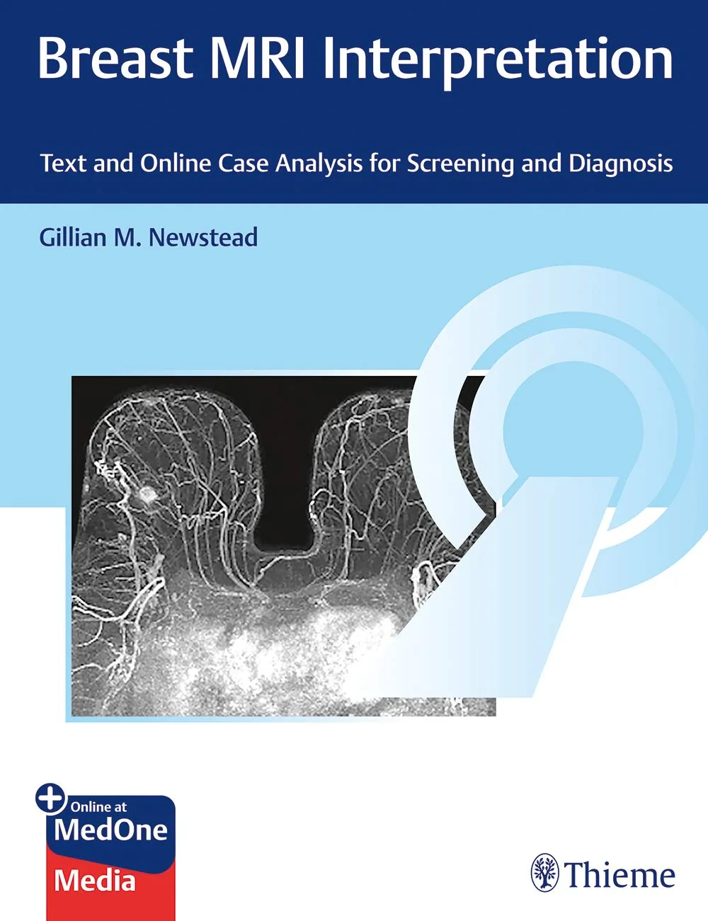 Coperta cărții "Breast MRI Interpretation: Text and Online Case Analysis for Screening and Diagnosis" de Gillian Newstead