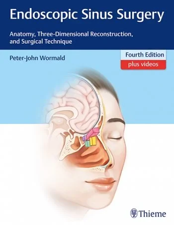Endoscopic Sinus Surgery