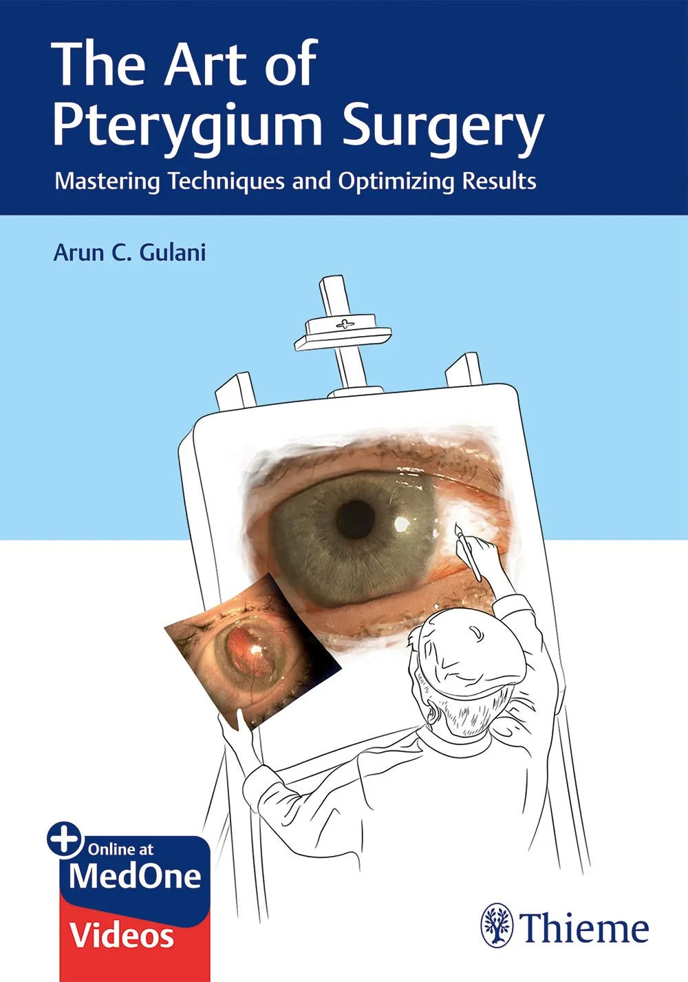 Coperta cărții "The Art of Pterygium Surgery: Mastering Techniques and Optimizing Results" de Arun C. Gulani