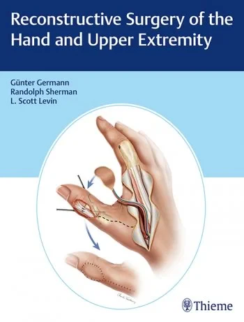 Reconstructive Surgery of the Hand and Upper Extre...