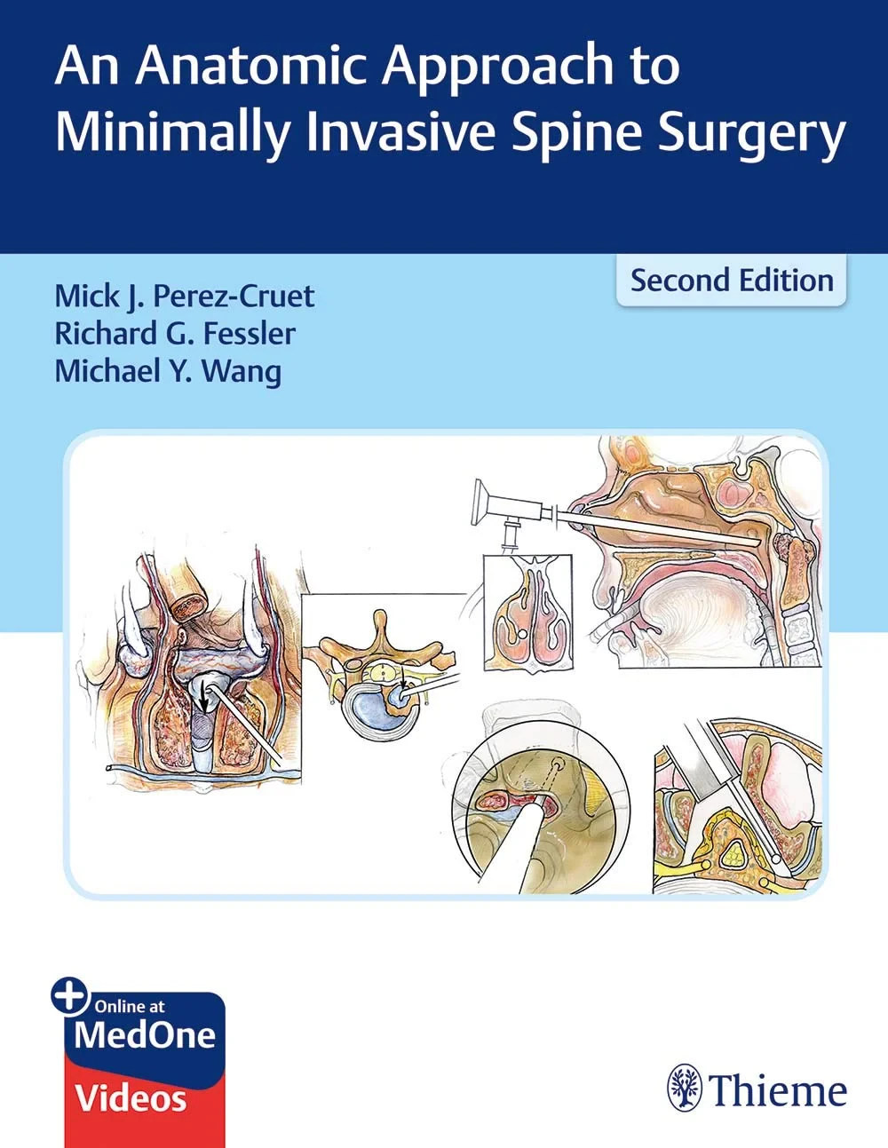 An Anatomic Approach to Minimally Invasive Spine S...