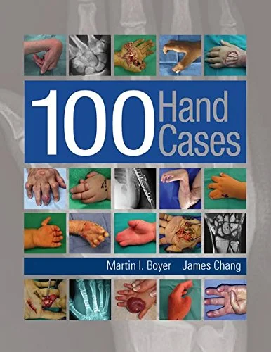 Coperta cărții "100 Hand Cases" de Martin I. Boyer, Dr. James Chang