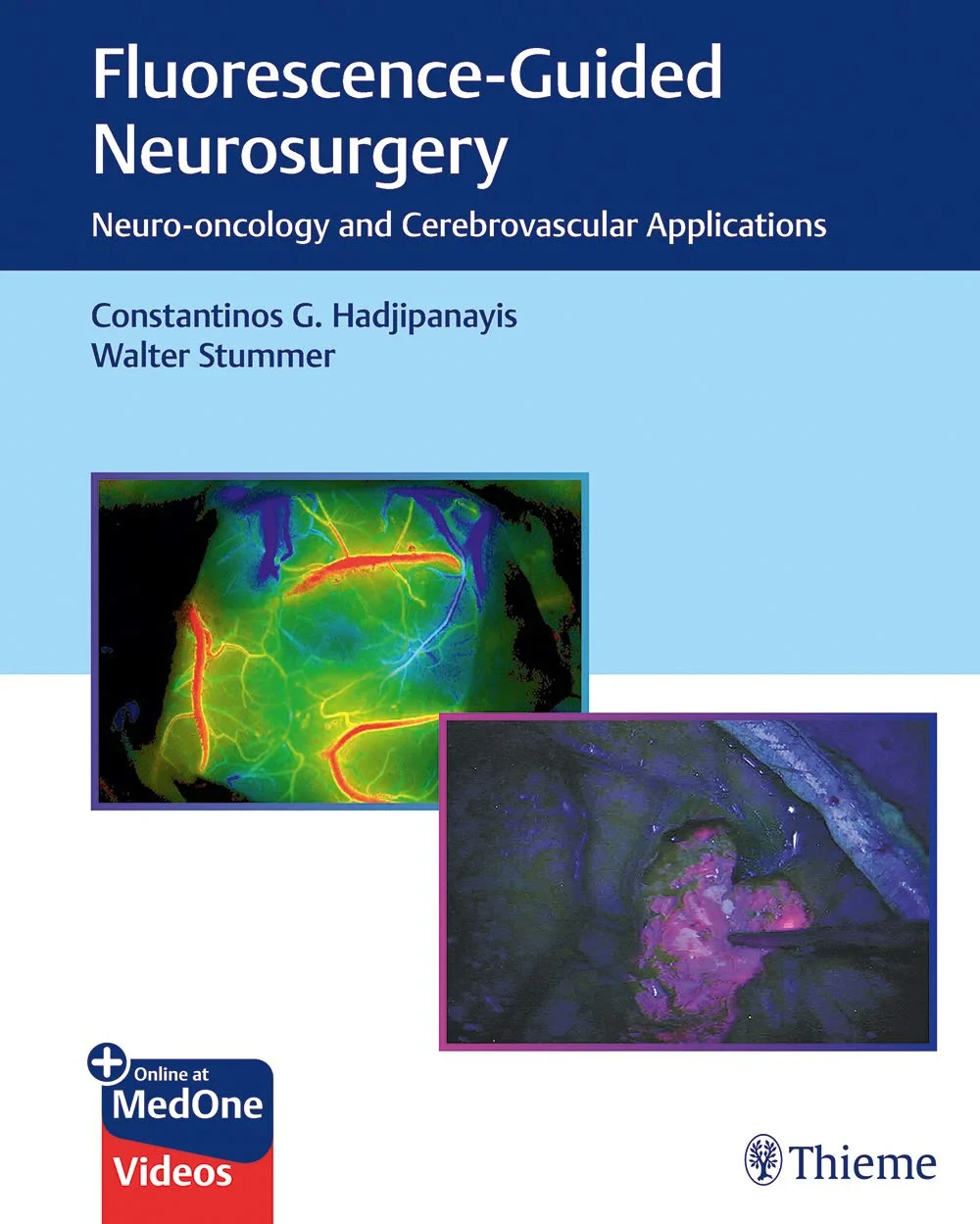 Coperta cărții "Fluorescence-Guided Neurosurgery: Neuro-oncology and Cerebrovascular Applications " de Constantinos G. Hadjipanayis, Walter Stummer