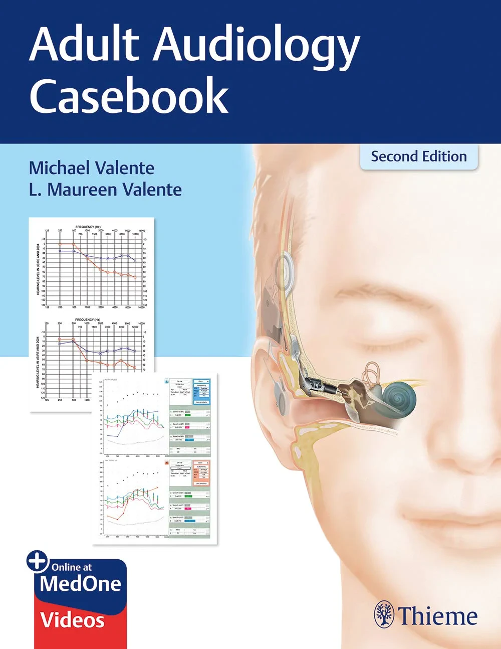 Coperta cărții "Adult Audiology Casebook " de Michael Valente, L. Valente