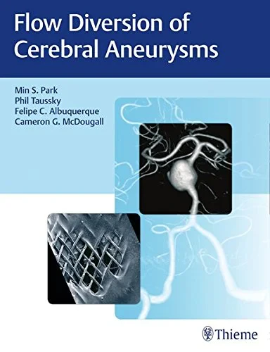 Coperta cărții "Flow Diversion of Cerebral Aneurysms" de Min S. Park, Philipp Taussky, Felipe C. Albuquerque, Cameron G. McDougall