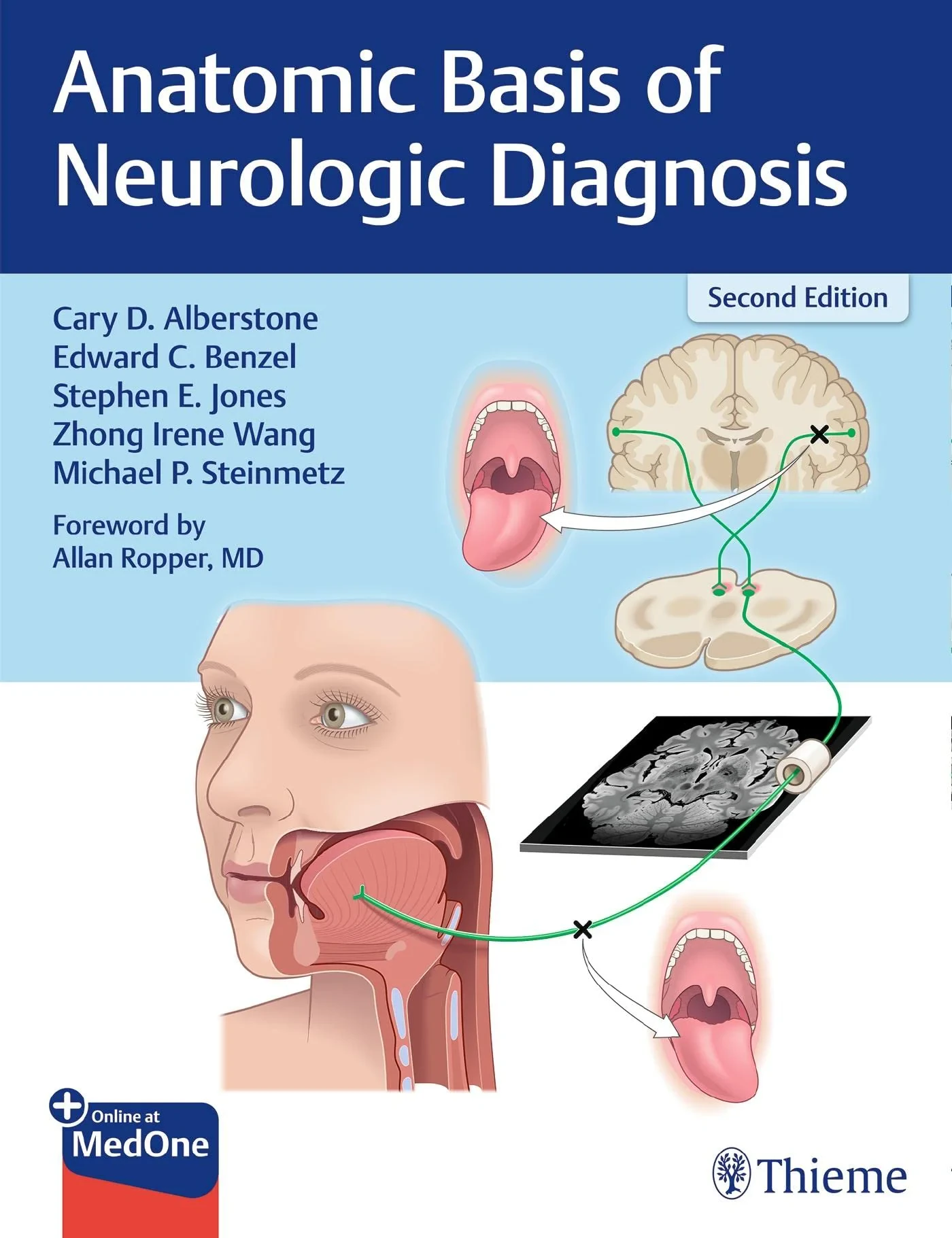 Coperta cărții "Anatomic Basis of Neurologic Diagnosis" de Edward C. Benzel, Cary Alberstone, Michael Steinmetz