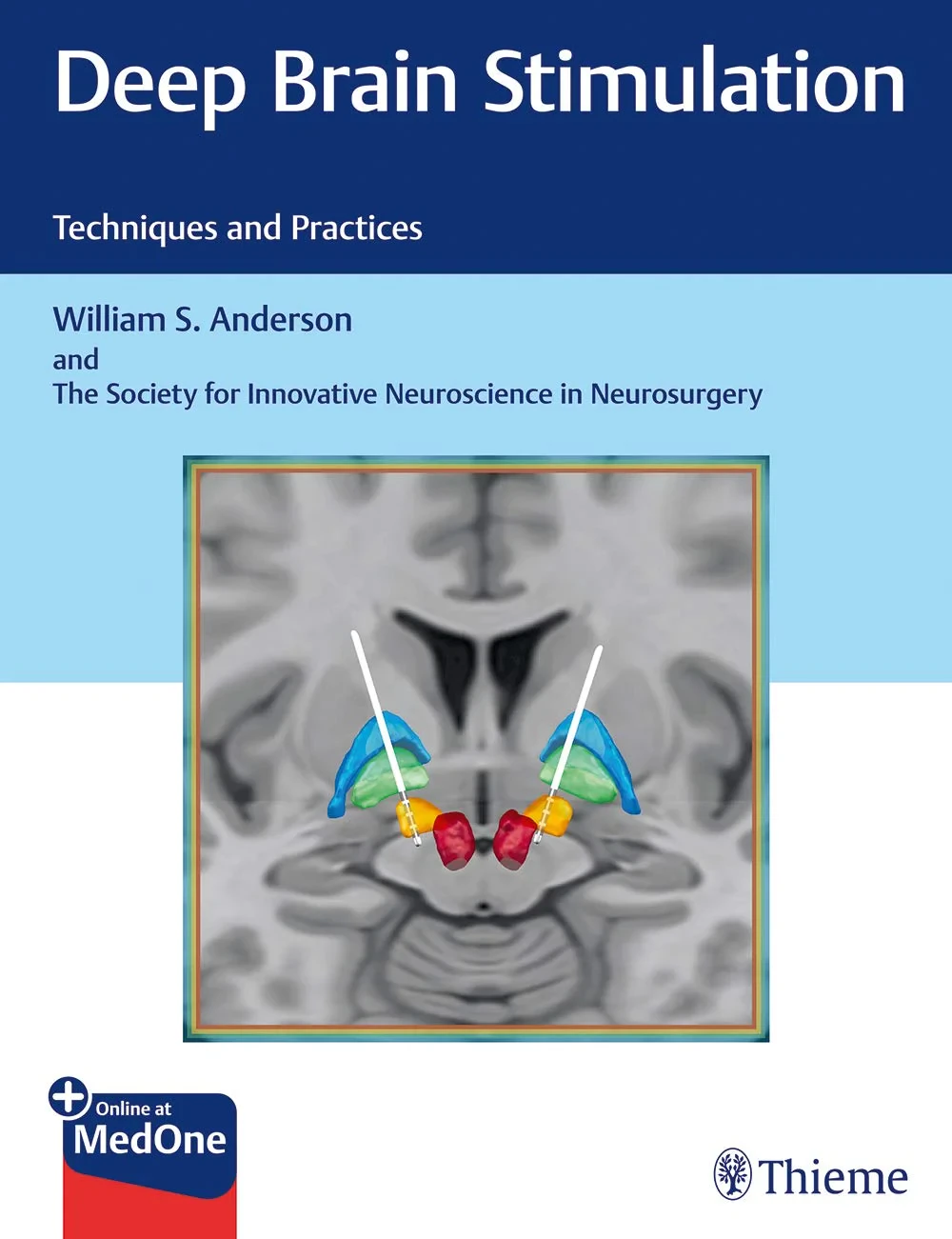 Coperta cărții "Deep Brain Stimulation: Techniques and Practices" de William Anderson