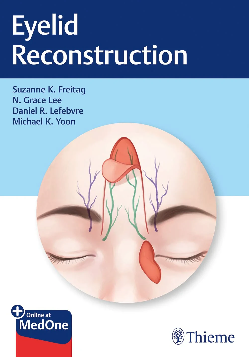 Coperta cărții "Eyelid Reconstruction" de Nahyoung Grace Lee, Suzanne K. Freitag, Daniel R. Lefebvre, Michael K. Yoon
