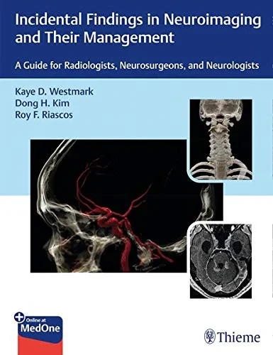Coperta cărții "Incidental Findings in Neuroimaging and Their Management: A Guide for Radiologists, Neurosurgeons, and Neurologists" de Kaye Westmark, Dong Kim, Roy Riascos