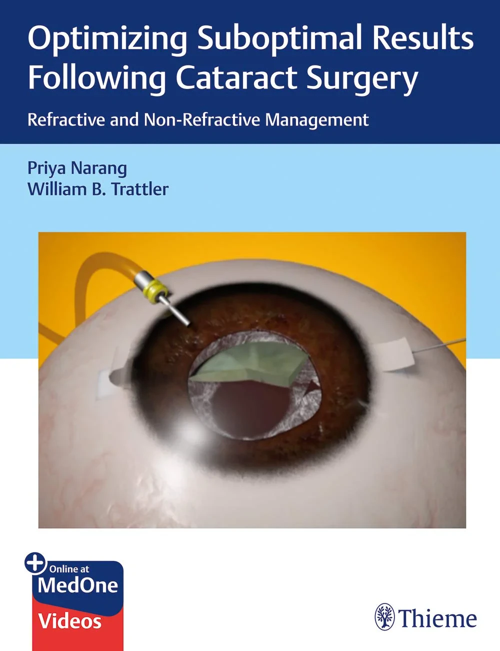 Coperta cărții "Optimizing Suboptimal Results Following Cataract Surgery: Refractive and Non-Refractive Management" de Priya Narang, William Trattler