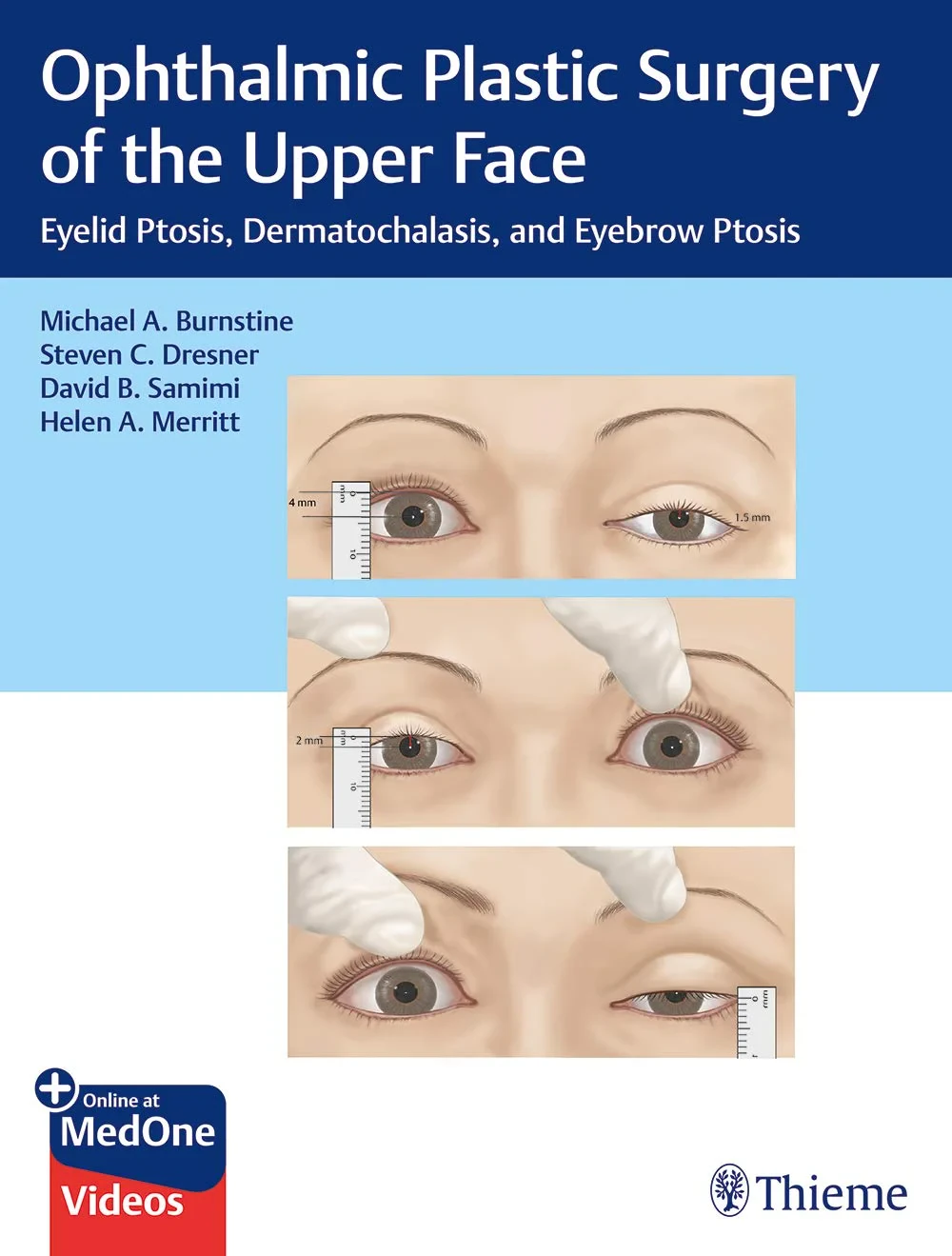 Coperta cărții "Ophthalmic Plastic Surgery of the Upper Face" de Michael Burnstine, Steven Dresner, David Samimi