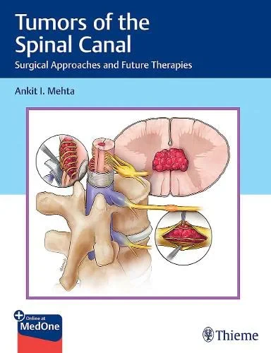 Coperta cărții "Tumors of the Spinal Canal: Surgical Approaches and Future Therapies" de Ankit I. Mehta