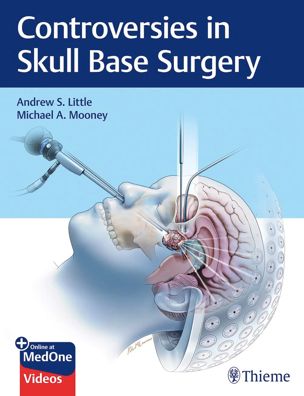 Coperta cărții "Controversies in Skull Base Surgery" de Andrew Little, Michael Mooney