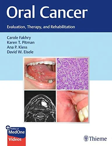 Oral Cancer: Evaluation, Therapy, and Rehabilitati...