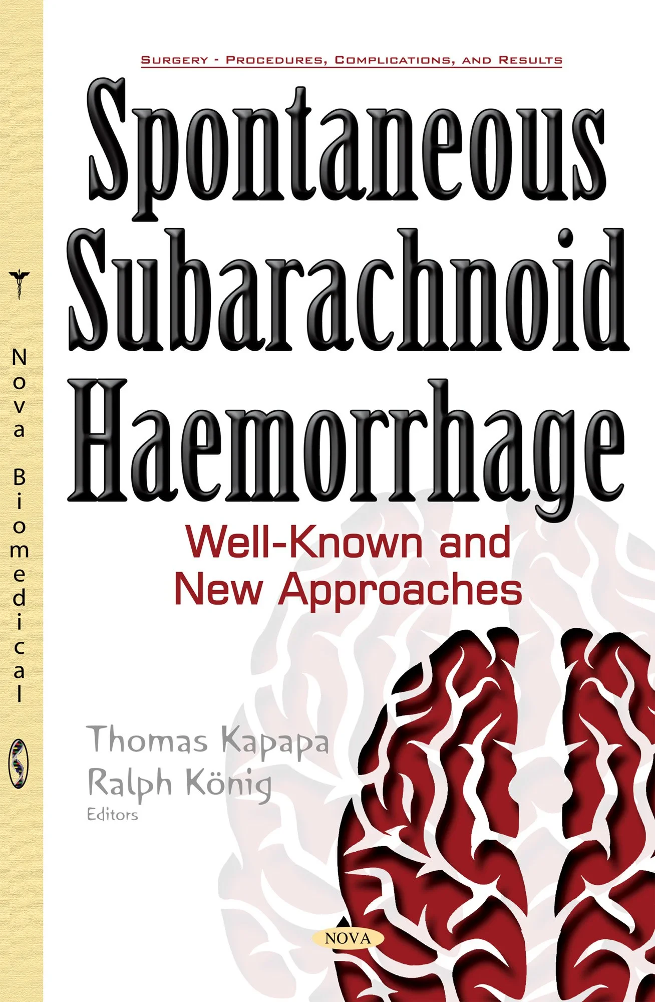 Coperta cărții "Spontaneous Subarachnoid Haemorrhage: Well-Known &amp; New Approaches" de Thomas Kapapa, Ralph König