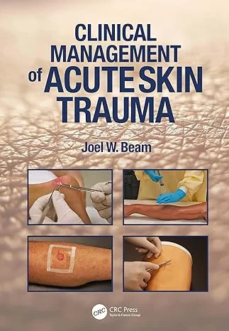Coperta cărții "Clinical Management of Acute Skin Trauma" de Joel W. Beam
