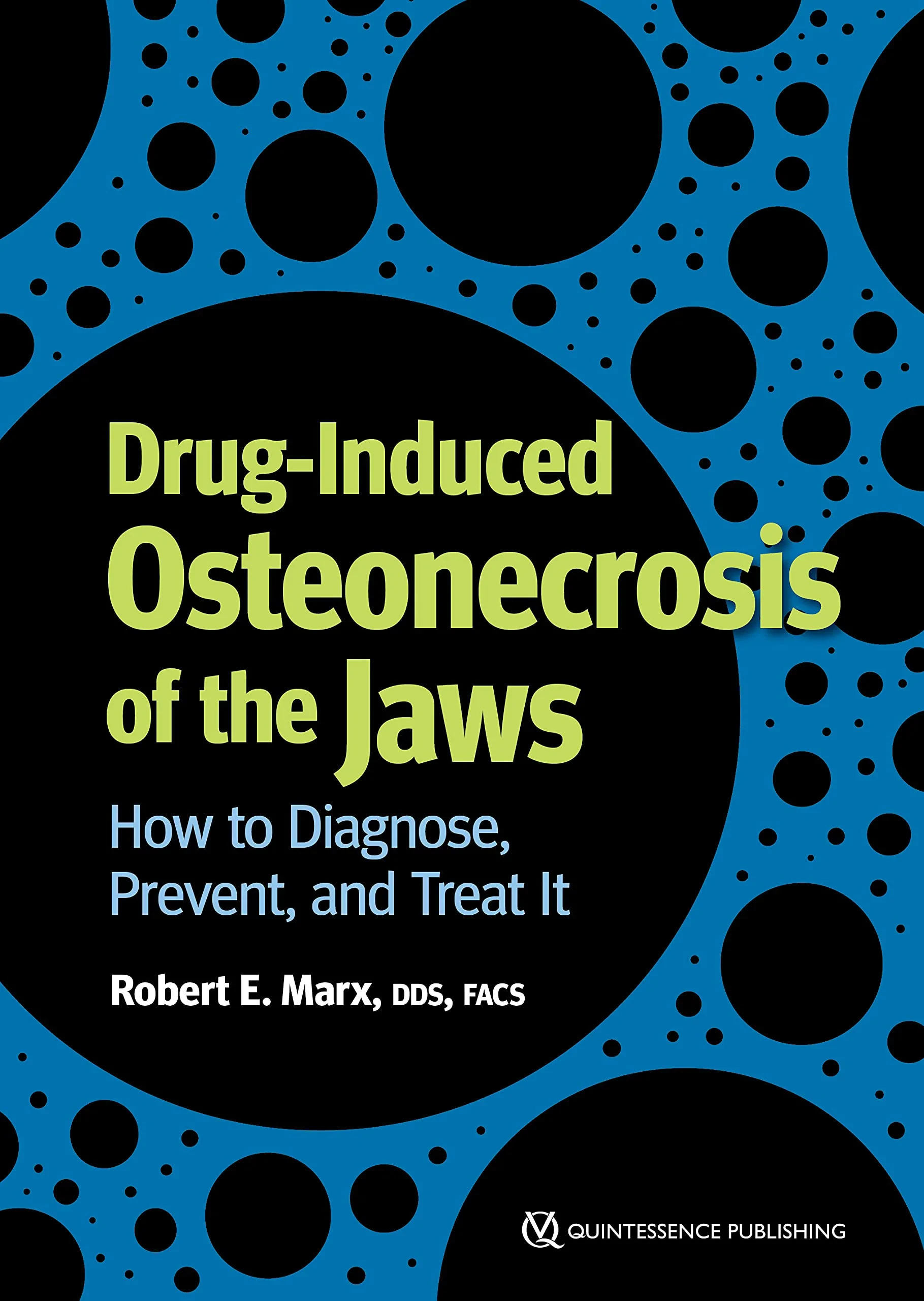 Coperta cărții "Drug-Induced Osteonecrosis of the Jaws: How to Diagnose, Prevent, and Treat It" de Marx, Robert E