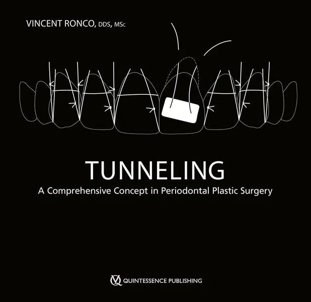 Coperta cărții "Tunneling" de Vincent Ronco