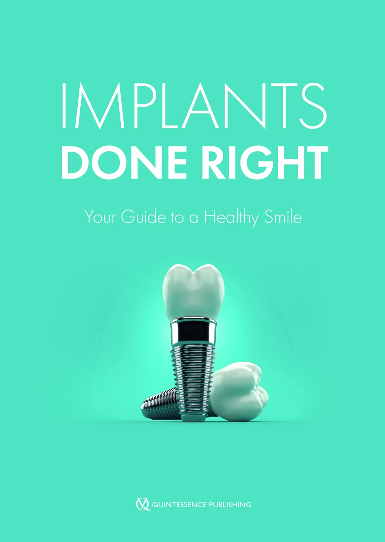Coperta cărții "Implants Done Right: Your Guide to a Healthy Smile" de John W. Thousand IV, Richard J. Miron