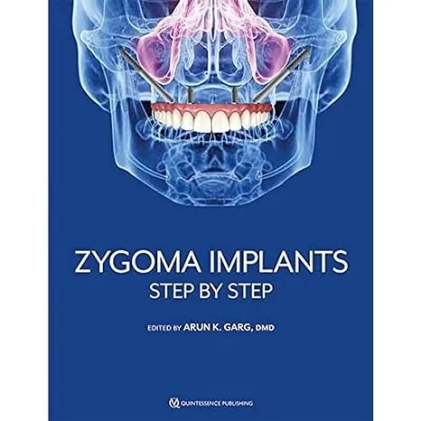 Coperta cărții "Zygoma Implants: Step by Step" de Arun K. Garg