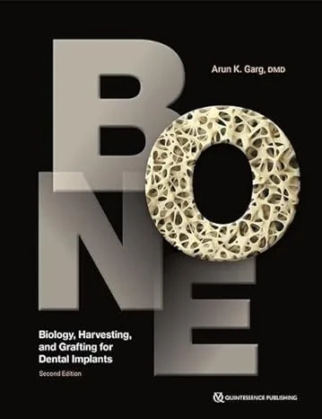 Coperta cărții "Bone.  Biology, Harvesting, and Grafting for Dental Implants" de Arun K. Garg