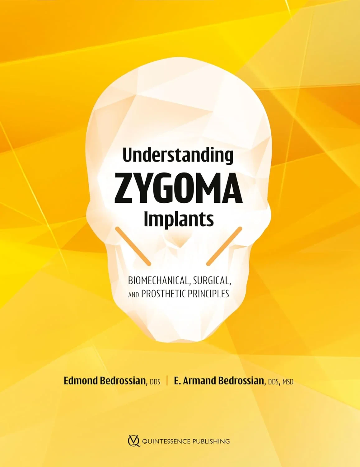 Understanding Zygoma Implants: Biomechanical, Surg...