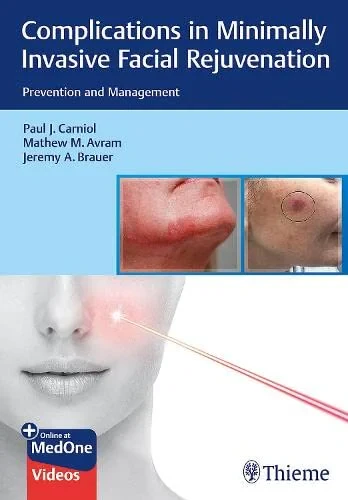 Coperta cărții "Complications in Minimally Invasive Facial Rejuvenation" de Paul J. Carniol, Mathew M. Avram, Jeremy A. Brauer