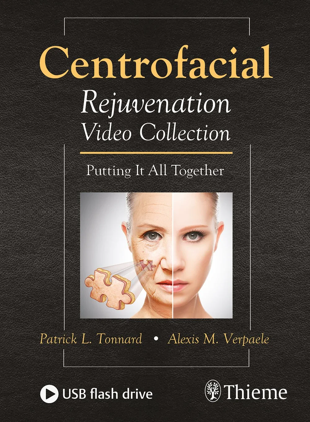Centrofacial Rejuvenation Video Collection: Puttin...