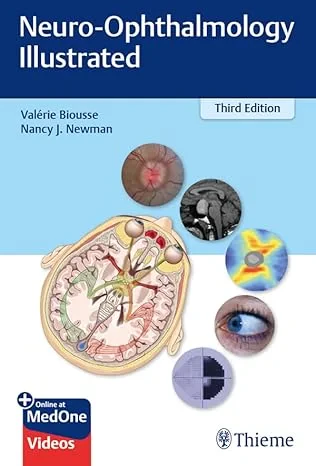 Coperta cărții "Neuro–Ophthalmology Illustrated" de Valerie Biousse, Nancy Newman
