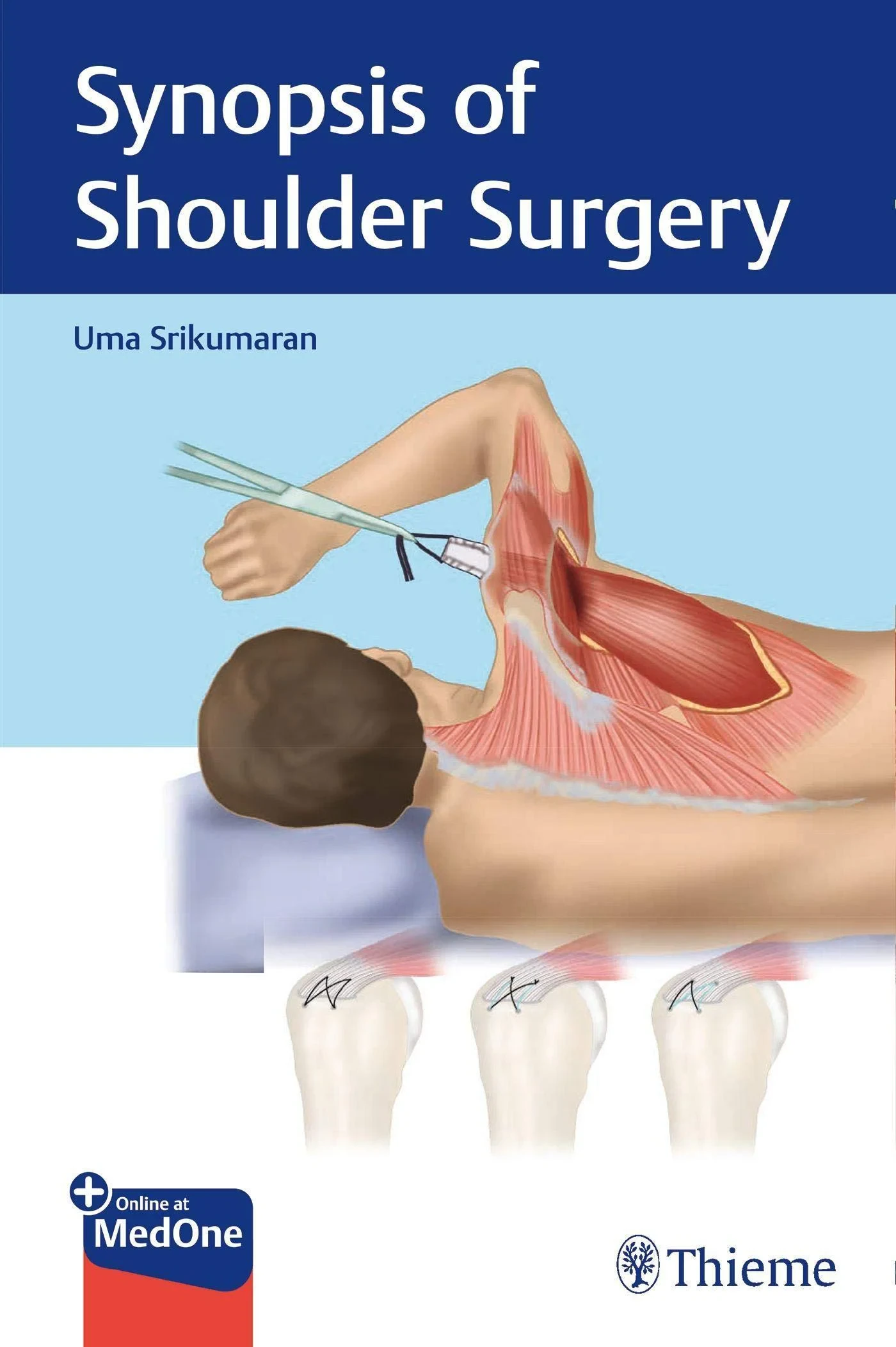 Coperta cărții "Synopsis of Shoulder Surgery " de Uma Srikumaran