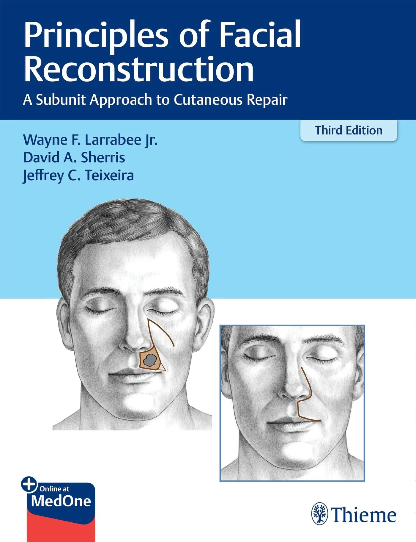 Coperta cărții "Principles of Facial Reconstruction" de Wayne F. Larrabee, David A. Sherris, Jeffrey Teixeira