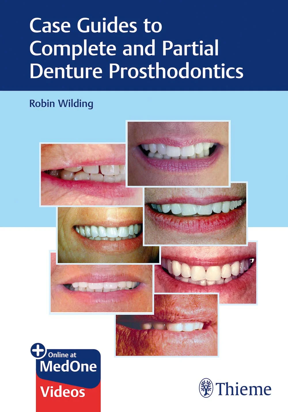 Coperta cărții "Case Guides to Complete and Partial Denture Prosthodontics" de Robin Wilding