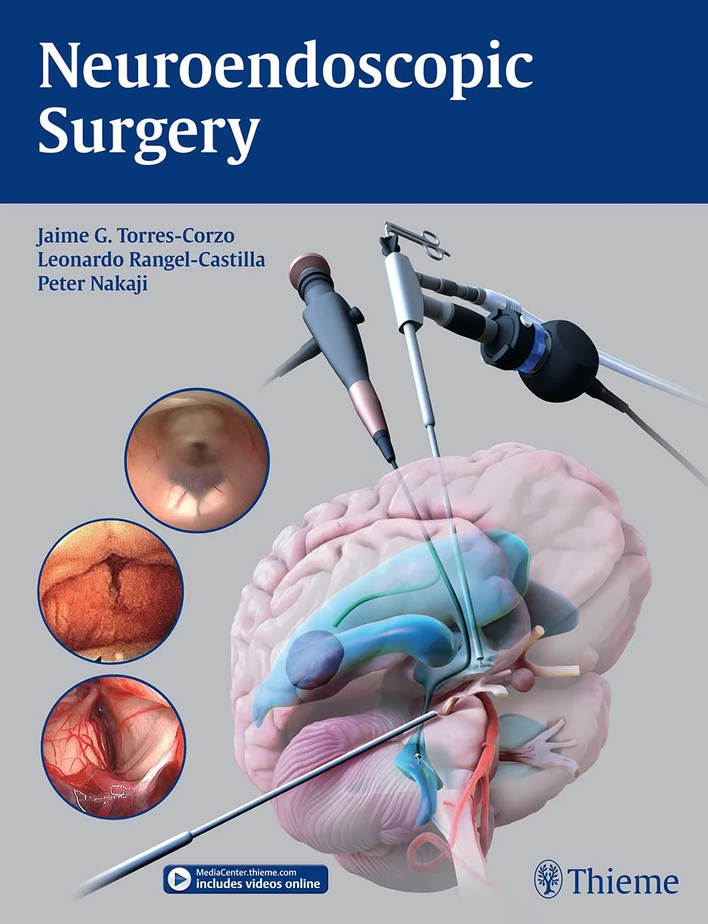 Coperta cărții "Neuroendoscopic Surgery" de Peter Nakaji, Jaime Torres-Corzo (, Leonardo Rangel-Castilla
